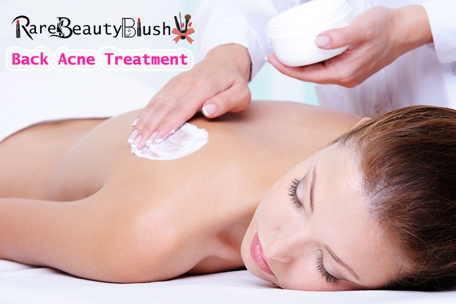 Back Acne Treatment Causes, Care, and Clear Skin Solutions