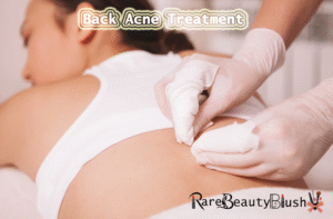 Back Acne Treatment Causes, Care, and Clear Skin Solutions